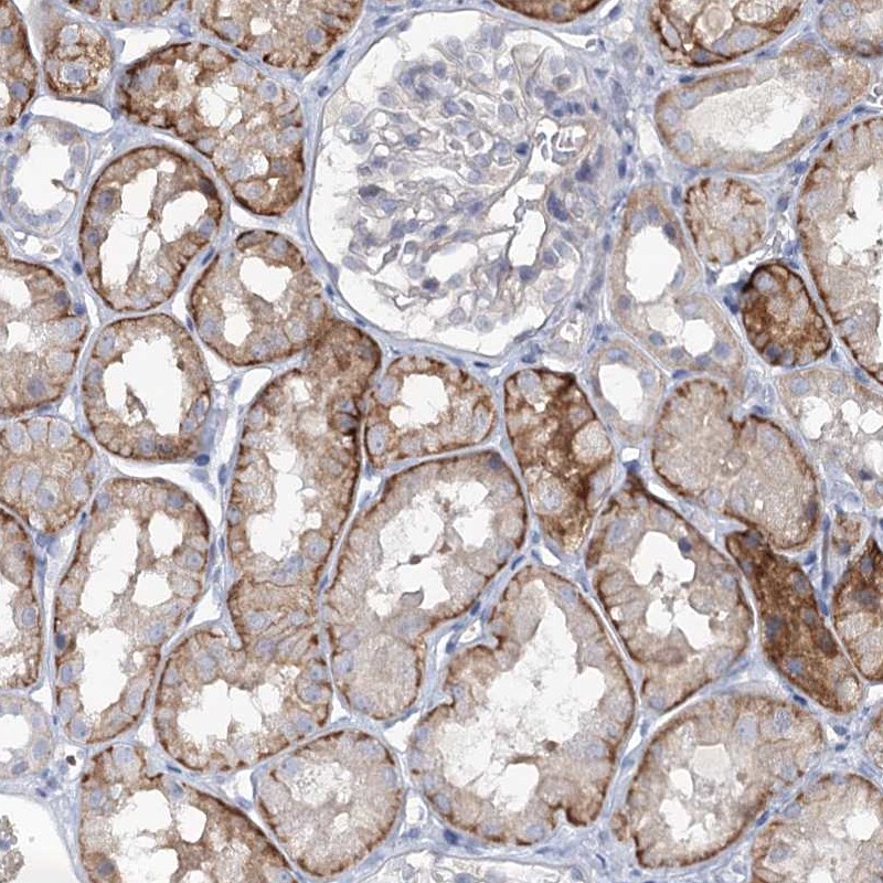 Atlas Antibodies Anti-MAP3K13 Antibody