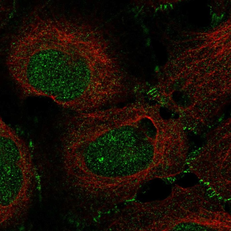 Atlas Antibodies Anti-MAP3K12 Antibody