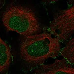 Atlas Antibodies Anti-MAP3K12 Antibody