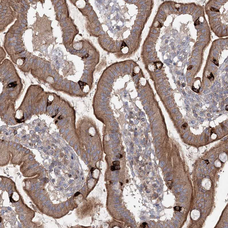 Atlas Antibodies Anti-MAP3K13 Antibody