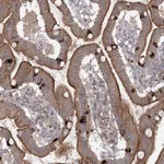 Atlas Antibodies Anti-MAP3K13 Antibody
