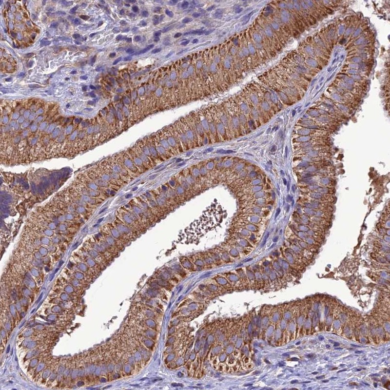 Atlas Antibodies Anti-MAP3K12 Antibody