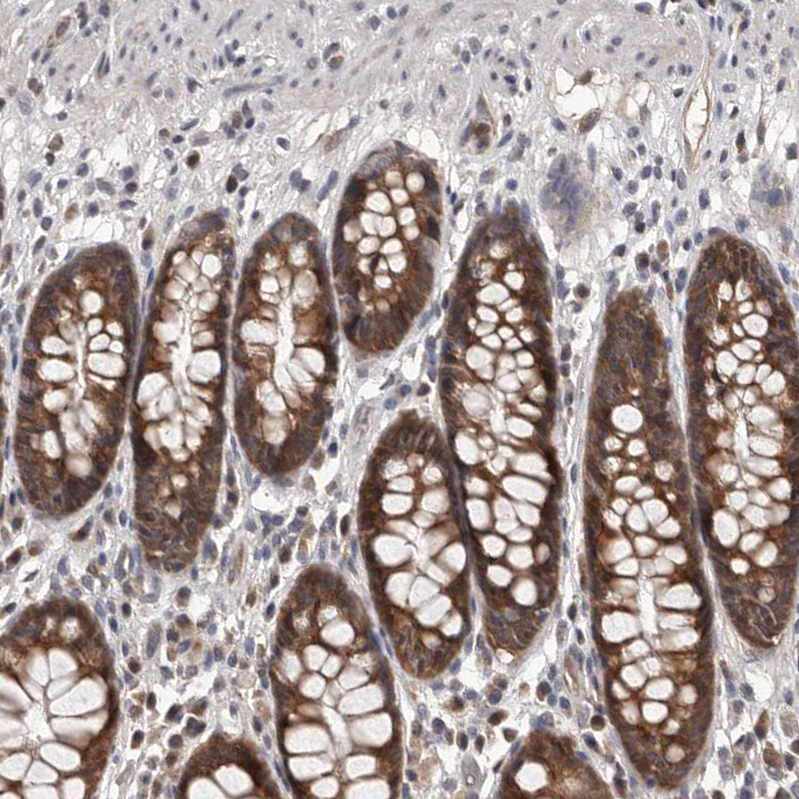 Atlas Antibodies Anti-MAP3K14 Antibody