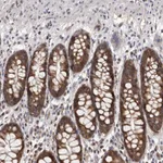Atlas Antibodies Anti-MAP3K14 Antibody