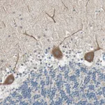 Atlas Antibodies Anti-MAP3K21 Antibody