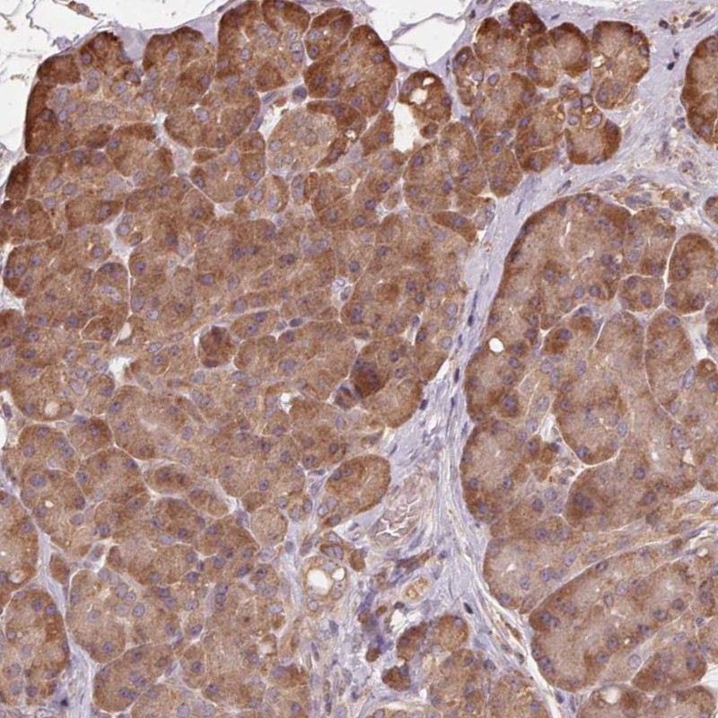 Atlas Antibodies Anti-MAP3K5 Antibody