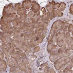Atlas Antibodies Anti-MAP3K5 Antibody