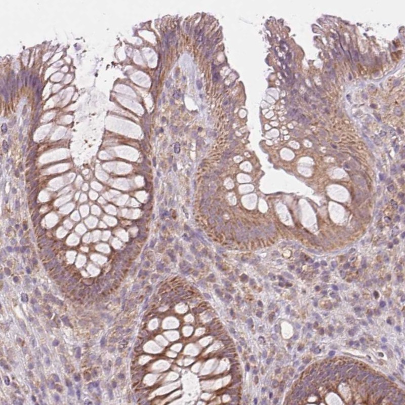 Atlas Antibodies Anti-MAP3K5 Antibody