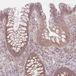 Atlas Antibodies Anti-MAP3K5 Antibody