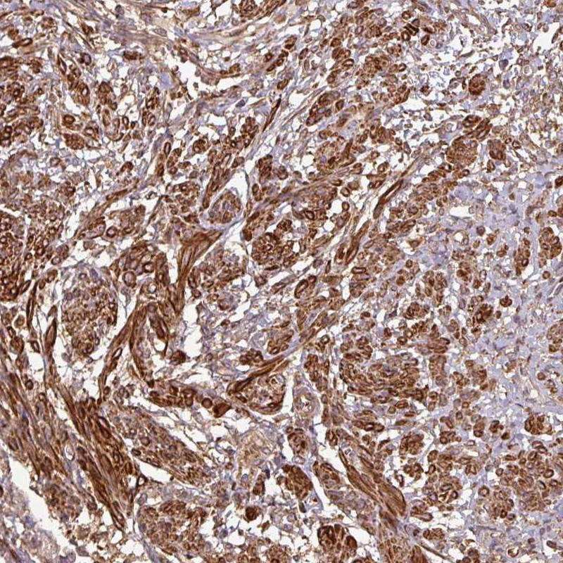 Atlas Antibodies Anti-MAP3K6 Antibody