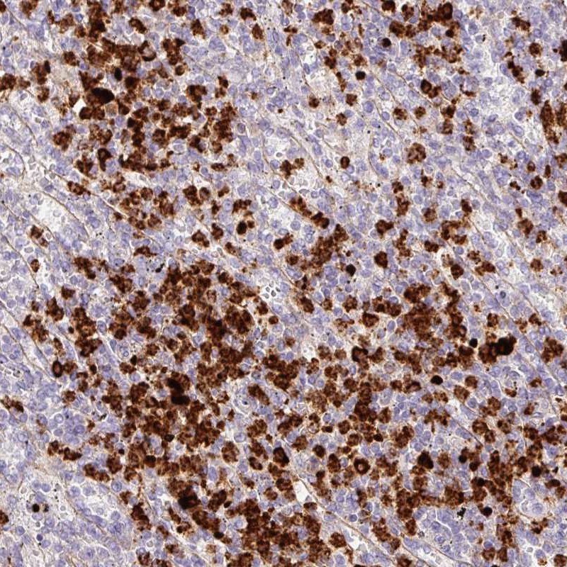 Atlas Antibodies Anti-MAP3K3 Antibody