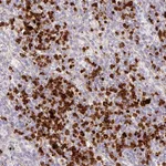 Atlas Antibodies Anti-MAP3K3 Antibody