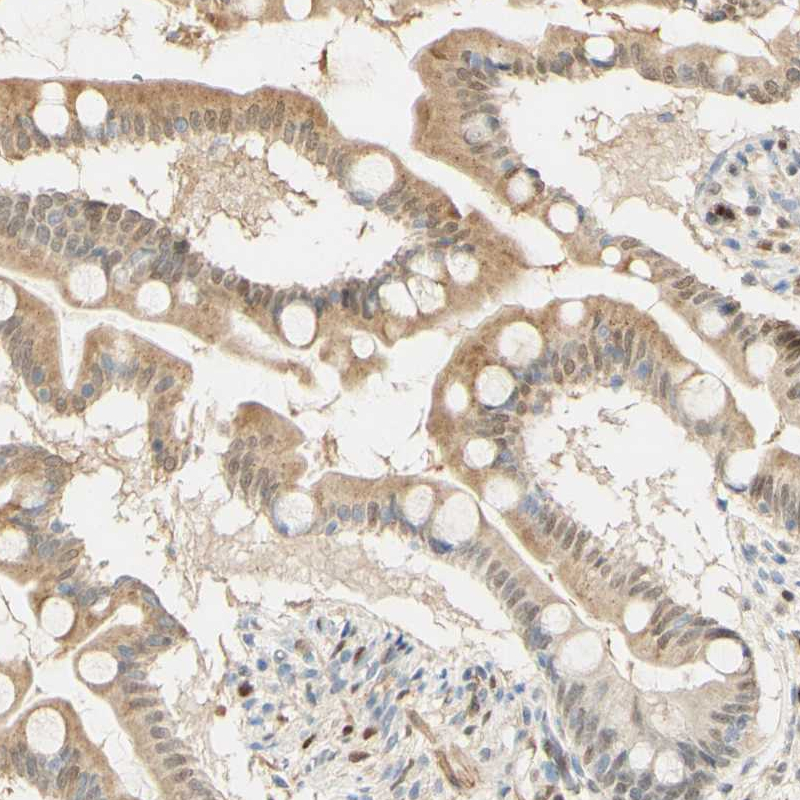 Atlas Antibodies Anti-MAP3K4 Antibody