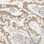 Atlas Antibodies Anti-MAP3K4 Antibody
