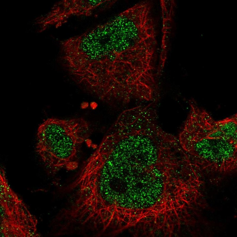 Atlas Antibodies Anti-MAP3K3 Antibody
