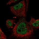 Atlas Antibodies Anti-MAP3K3 Antibody