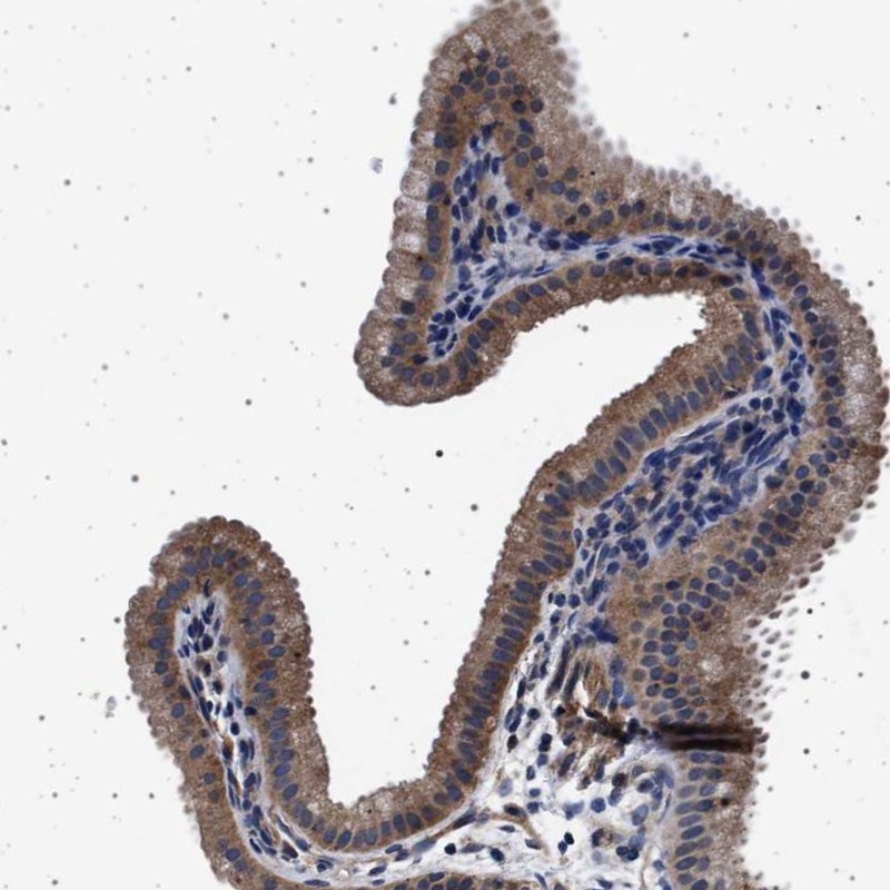 Atlas Antibodies Anti-MAP3K2 Antibody