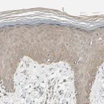 Atlas Antibodies Anti-MAP3K7 Antibody