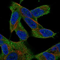 Atlas Antibodies Anti-MAP3K7 Antibody