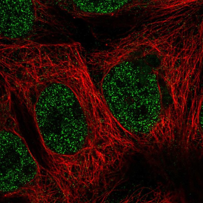 Atlas Antibodies Anti-MAP3K7CL Antibody