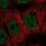 Atlas Antibodies Anti-MAP3K7CL Antibody