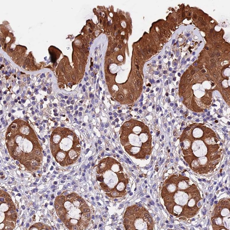 Atlas Antibodies Anti-MAP3K7CL Antibody