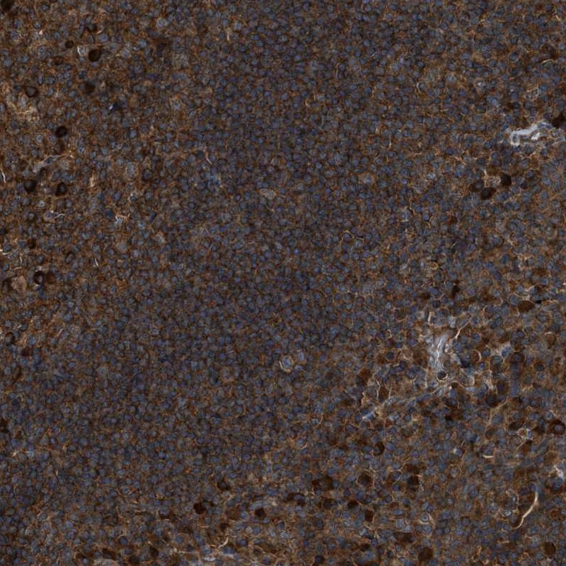 Atlas Antibodies Anti-MAP3K8 Antibody