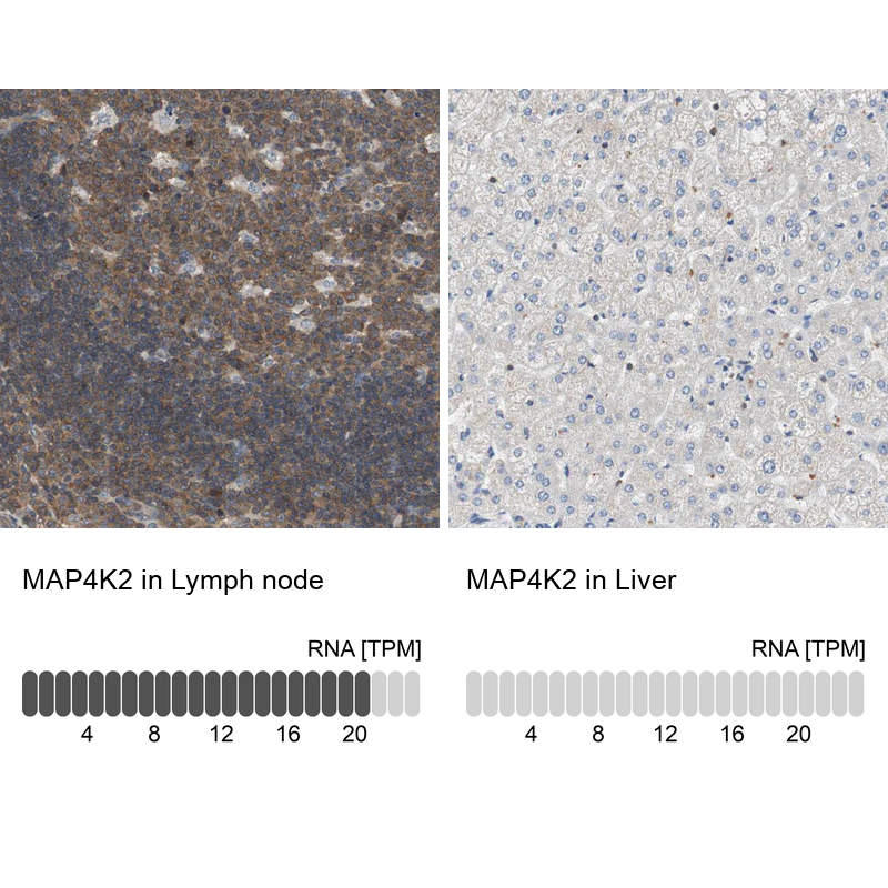 Atlas Antibodies Anti-MAP4K2 Antibody