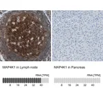 Atlas Antibodies Anti-MAP4K1 Antibody