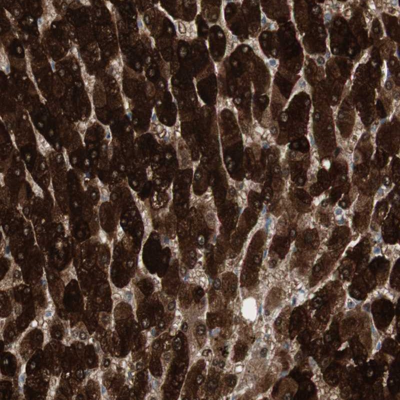 Atlas Antibodies Anti-MAP4K4 Antibody