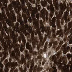 Atlas Antibodies Anti-MAP4K4 Antibody