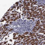 Atlas Antibodies Anti-MAP3K9 Antibody