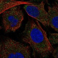Atlas Antibodies Anti-MAP4K5 Antibody