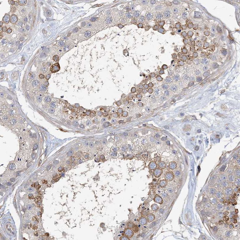 Atlas Antibodies Anti-MAP4K5 Antibody