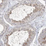 Atlas Antibodies Anti-MAP4K5 Antibody