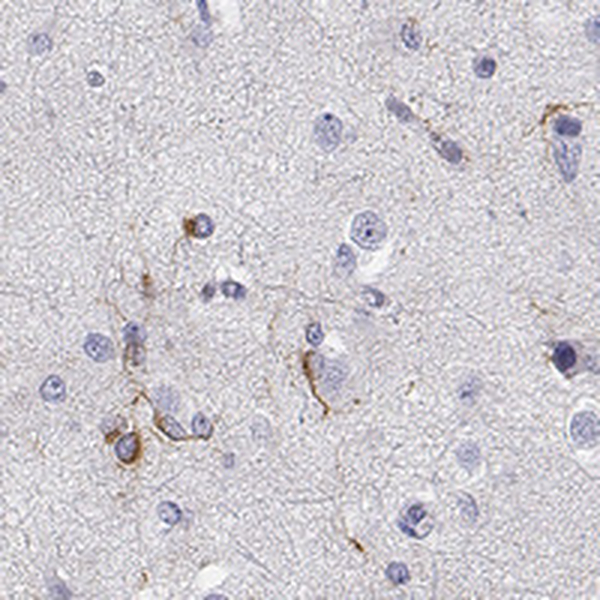 Atlas Antibodies Anti-MAP6D1 Antibody