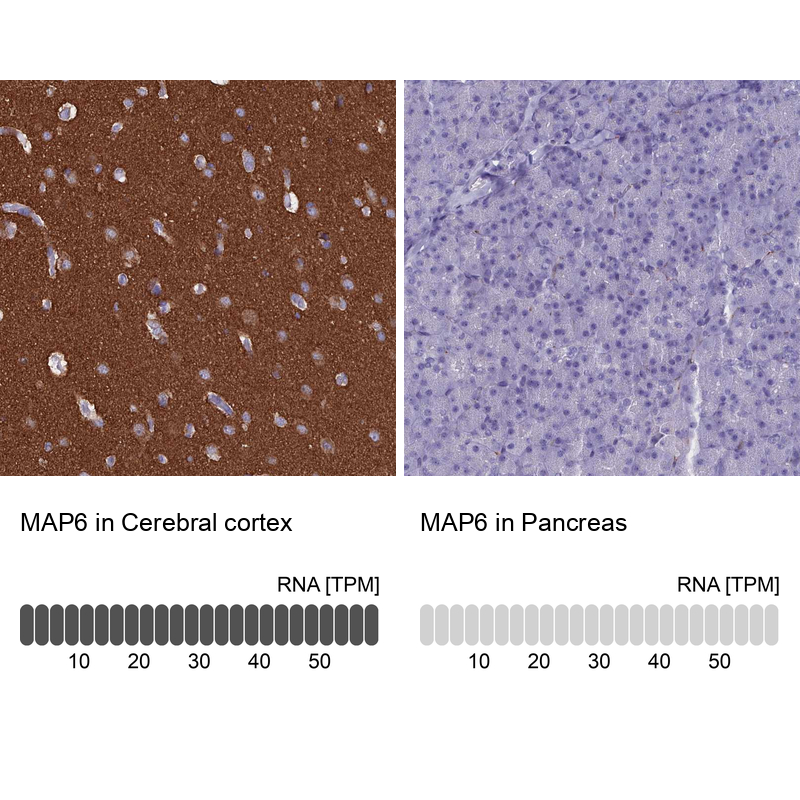 Atlas Antibodies Anti-MAP6 Antibody