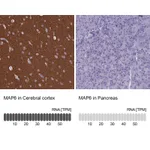 Atlas Antibodies Anti-MAP6 Antibody