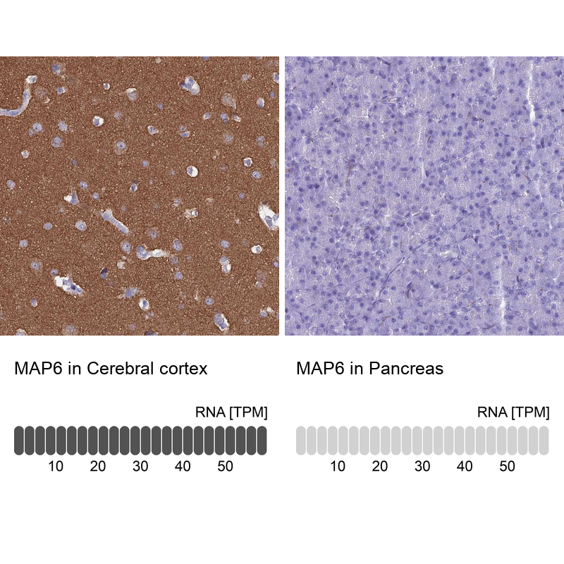 Atlas Antibodies Anti-MAP6 Antibody