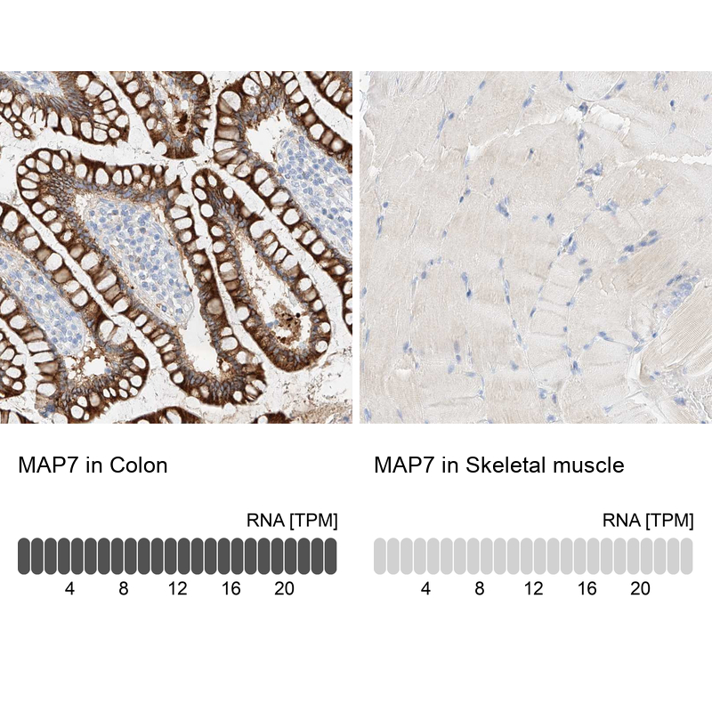 Atlas Antibodies Anti-MAP7 Antibody