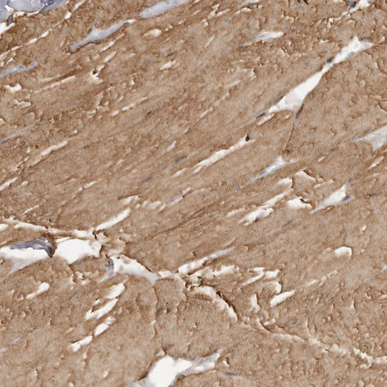 Atlas Antibodies Anti-MAP7D1 Antibody