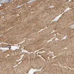Atlas Antibodies Anti-MAP7D1 Antibody