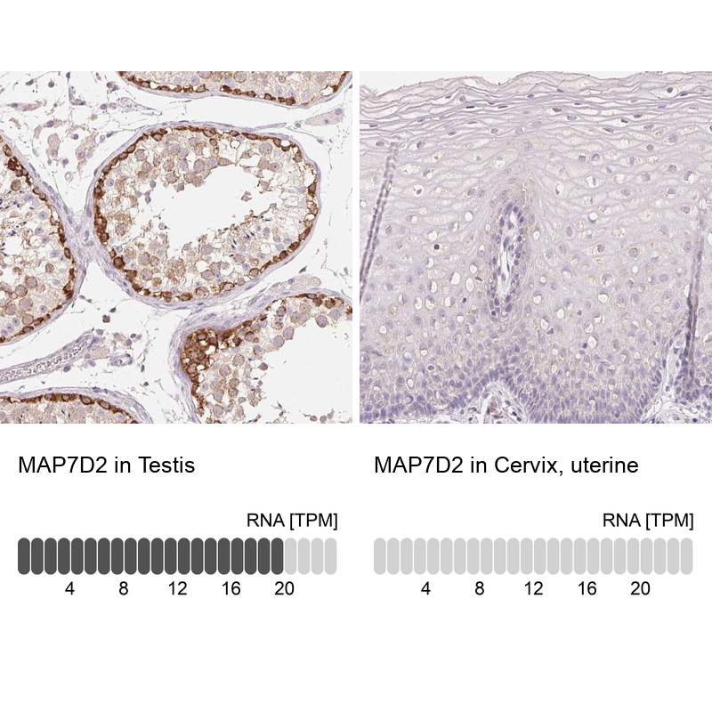 Atlas Antibodies Anti-MAP7D2 Antibody