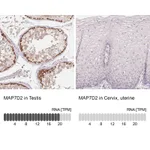 Atlas Antibodies Anti-MAP7D2 Antibody