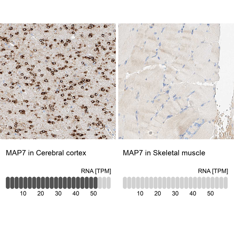 Atlas Antibodies Anti-MAP7 Antibody