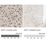 Atlas Antibodies Anti-MAP7 Antibody