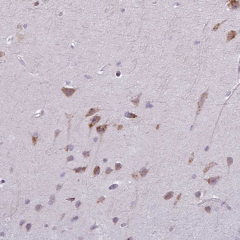 Atlas Antibodies Anti-MAP7D2 Antibody