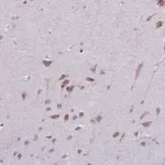 Atlas Antibodies Anti-MAP7D2 Antibody
