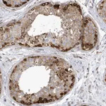 Atlas Antibodies Anti-MAP7D3 Antibody