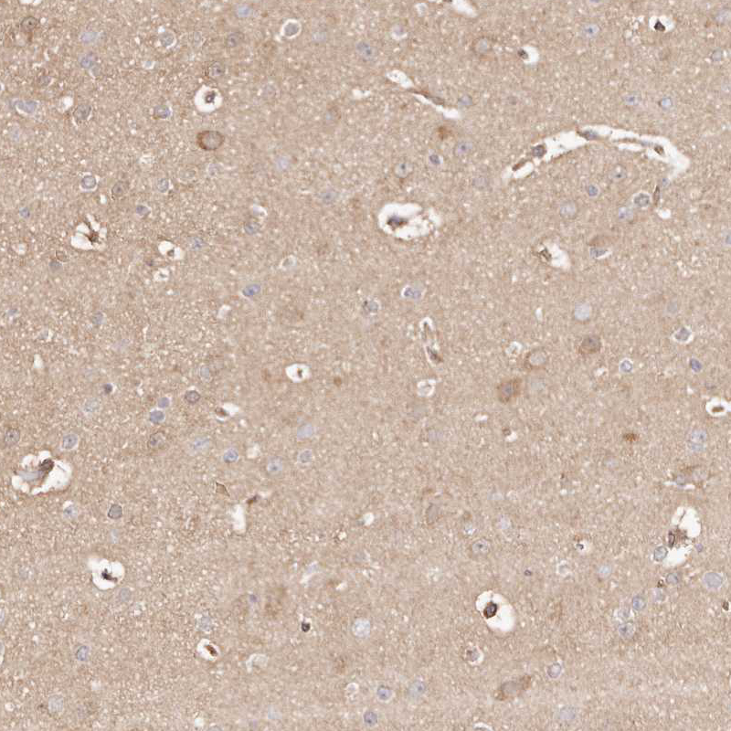 Atlas Antibodies Anti-MAPK1 Antibody